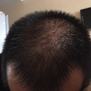 发际线分享社区