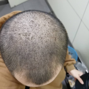 发际线分享社区