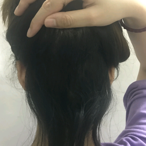 发际线分享社区