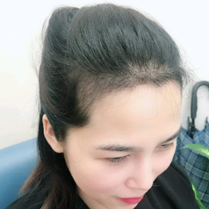 发际线分享社区