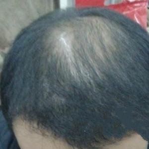 发际线分享社区