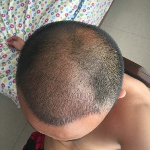 发际线分享社区
