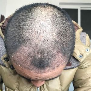 发际线分享社区