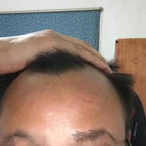 发际线分享社区