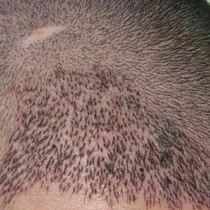 发际线分享社区