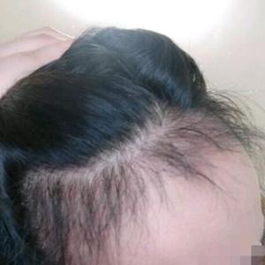 发际线分享社区