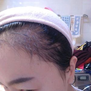 发际线分享社区