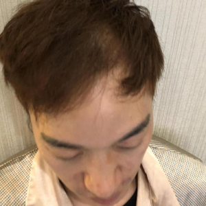 发际线分享社区
