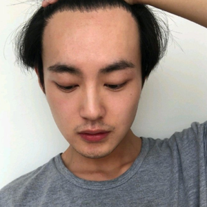 发际线分享社区