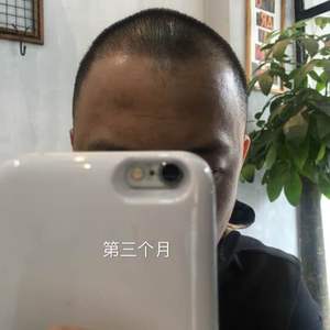 发际线分享社区