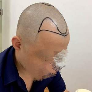 发际线分享社区
