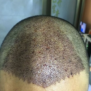 发际线分享社区
