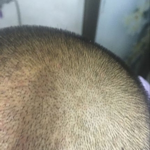 发际线分享社区