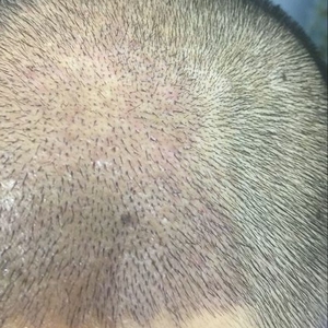 发际线分享社区