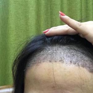 发际线分享社区