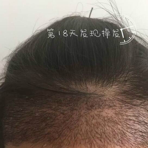 发际线分享社区