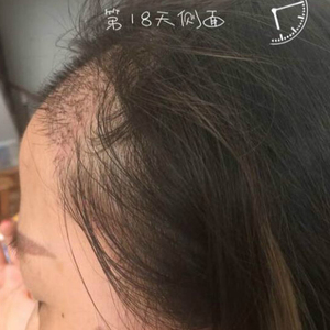 发际线分享社区