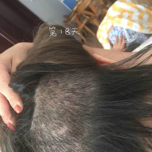 发际线分享社区