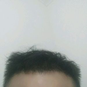 发际线分享社区