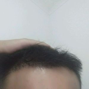 发际线分享社区
