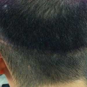 发际线分享社区