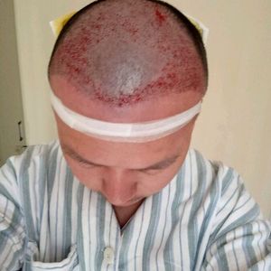 发际线分享社区