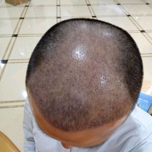 发际线分享社区