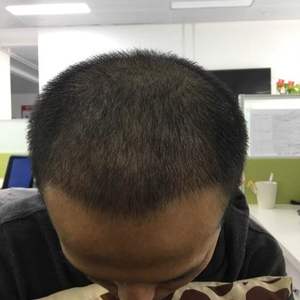 发际线分享社区