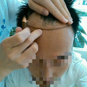 发际线分享社区