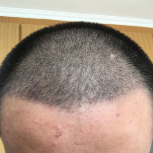 发际线分享社区