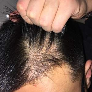 发际线分享社区