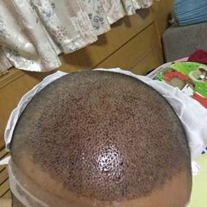 发际线分享社区