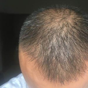 稀少加密分享社区