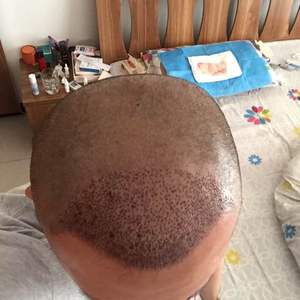发际线分享社区