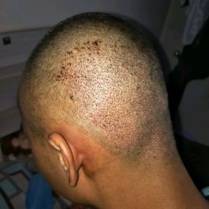 发际线分享社区
