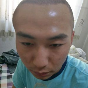 发际线分享社区