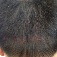<font color="red">稀少加密</font>用戶圖片