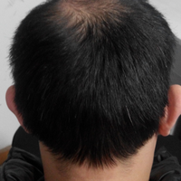 <font color="red">稀少加密</font>用戶圖片