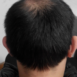 稀少加密分享社区