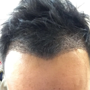 发际线分享社区