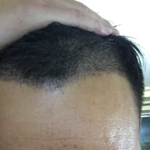发际线分享社区