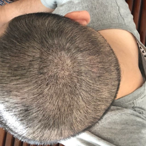 发际线分享社区