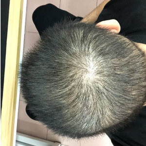 发际线分享社区