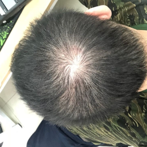 发际线分享社区