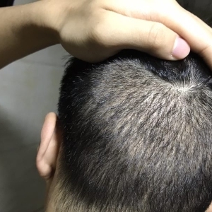 发际线分享社区