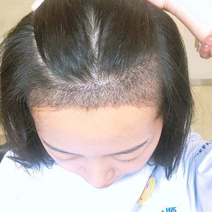 发际线分享社区