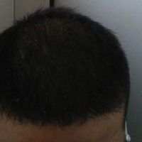 <font color="red">稀少加密</font>用戶圖片