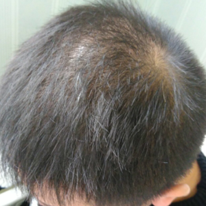 发际线分享社区