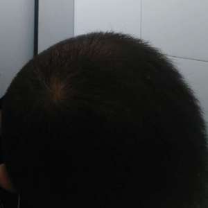 稀少加密分享社区