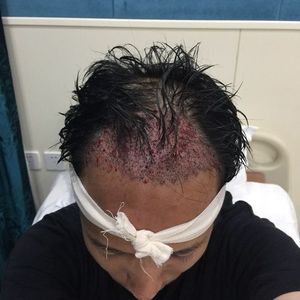 发际线分享社区